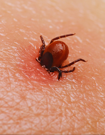 Tick burrowing on human skin