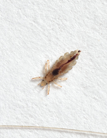 Head Lice Crawling