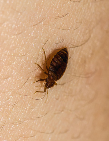 Bed bug crawling on human skin