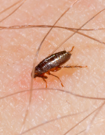 a little flea bites on a human - Flea Pest Control